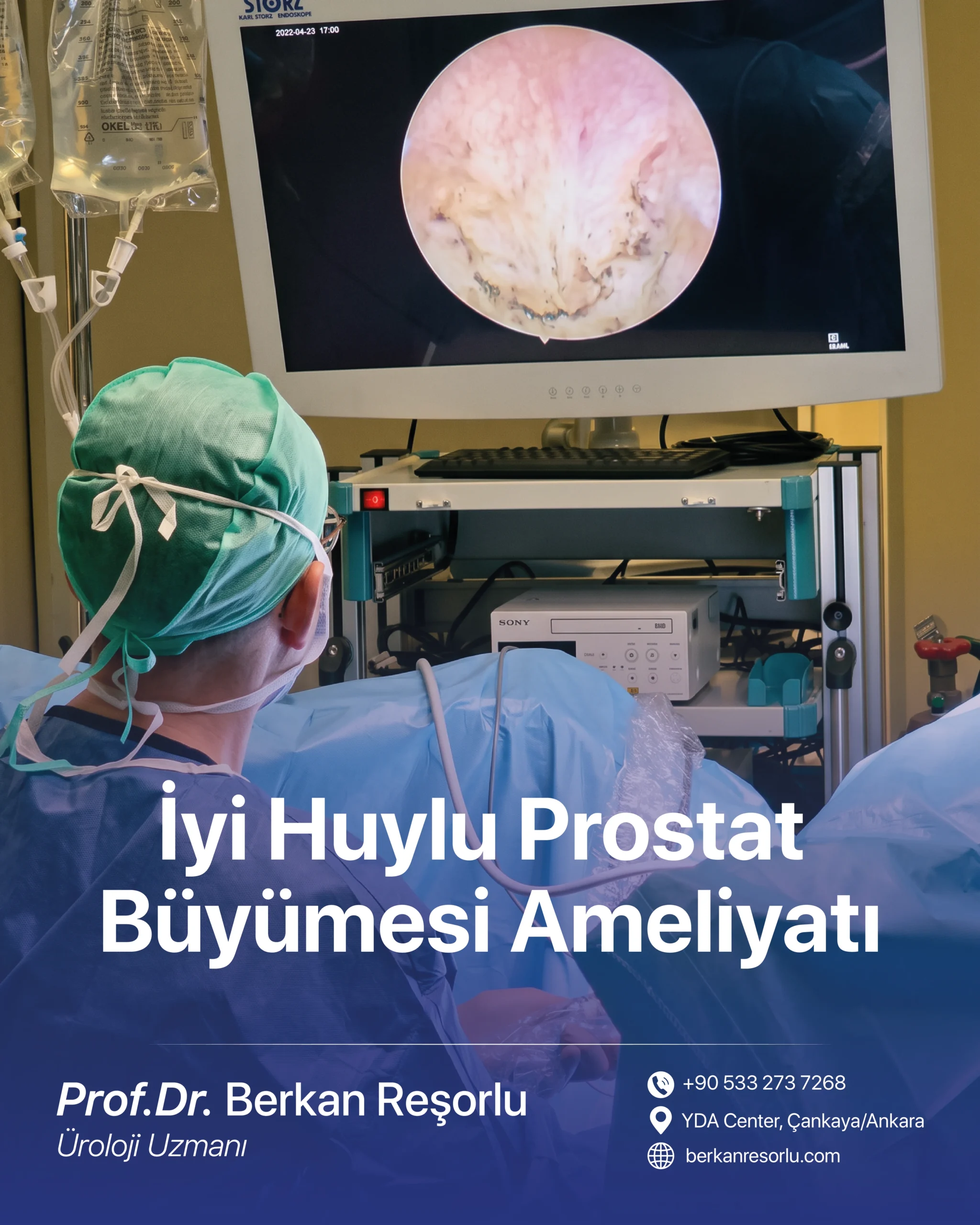 İyi Huylu Prostat Büyümesi Ameliyatı