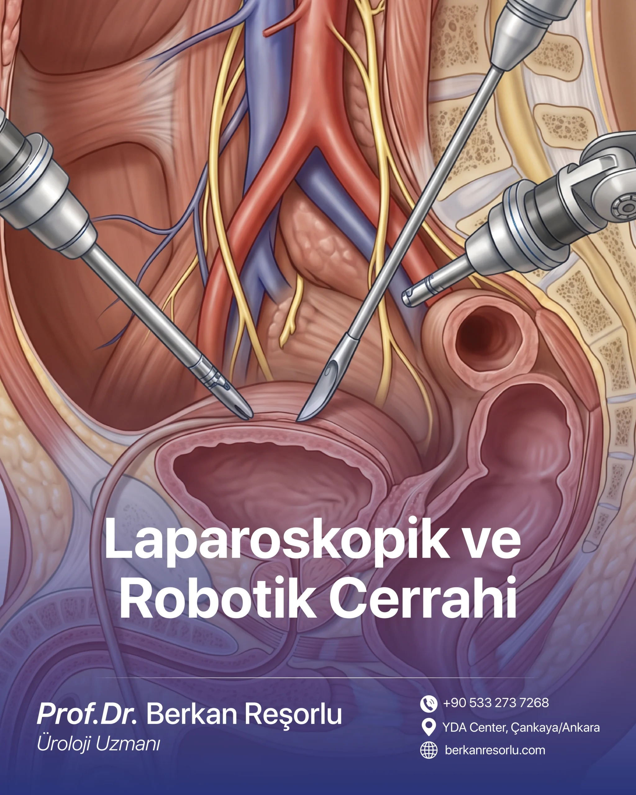 Laparoskopik ve Robotik Cerrahi