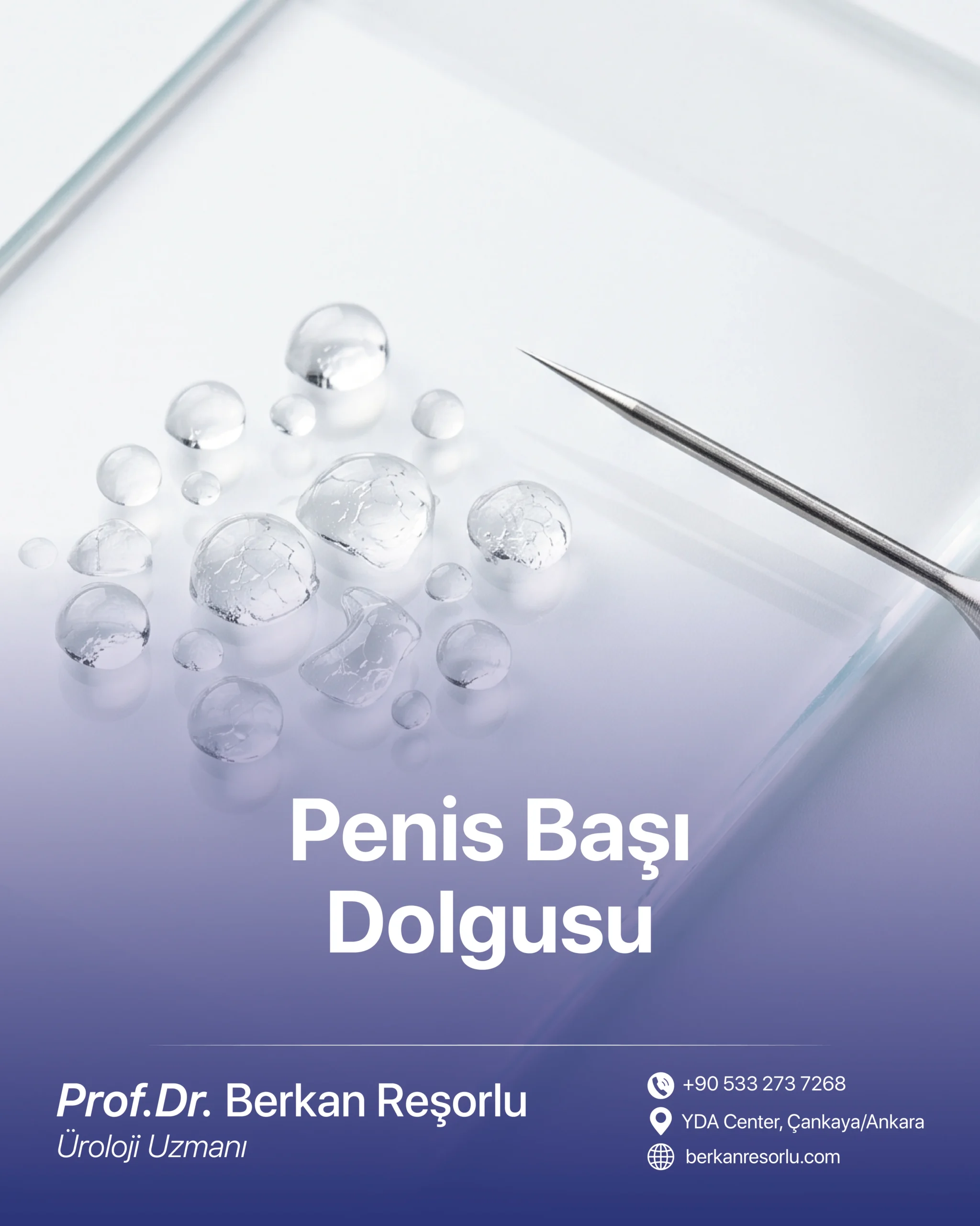 Penis Başı Dolgusu