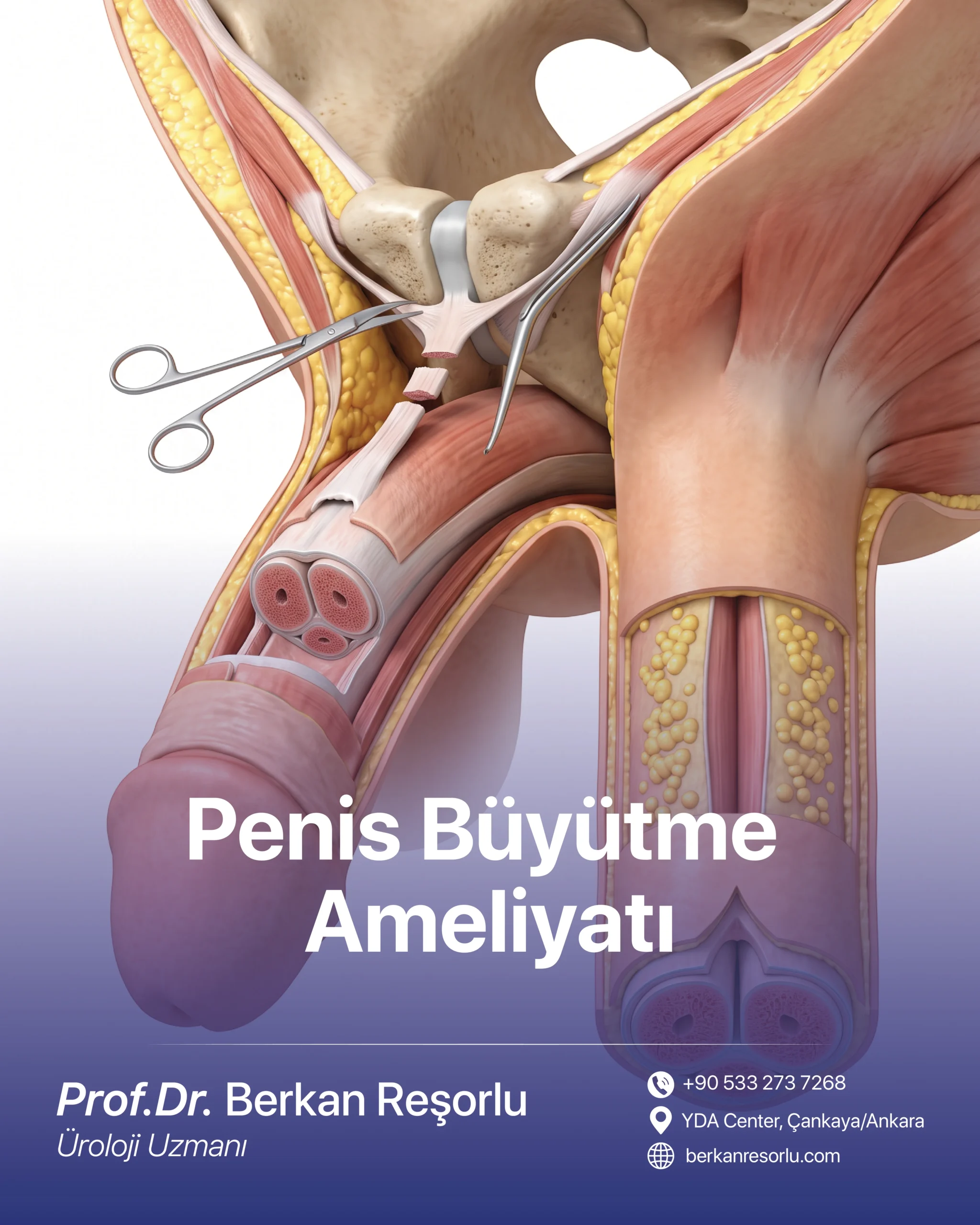 Penis Büyütme Ameliyatı
