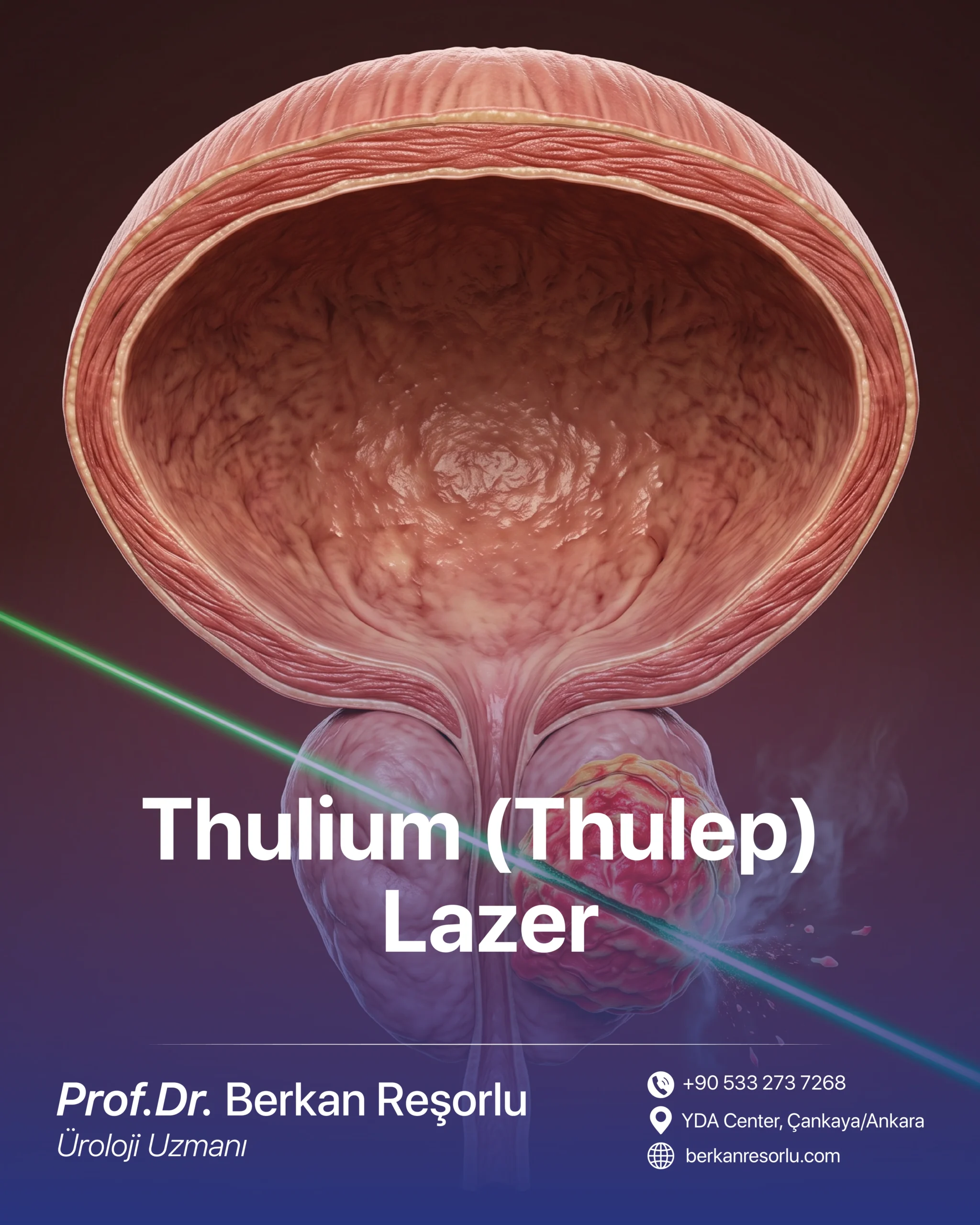 Thulium (Thulep) Lazer